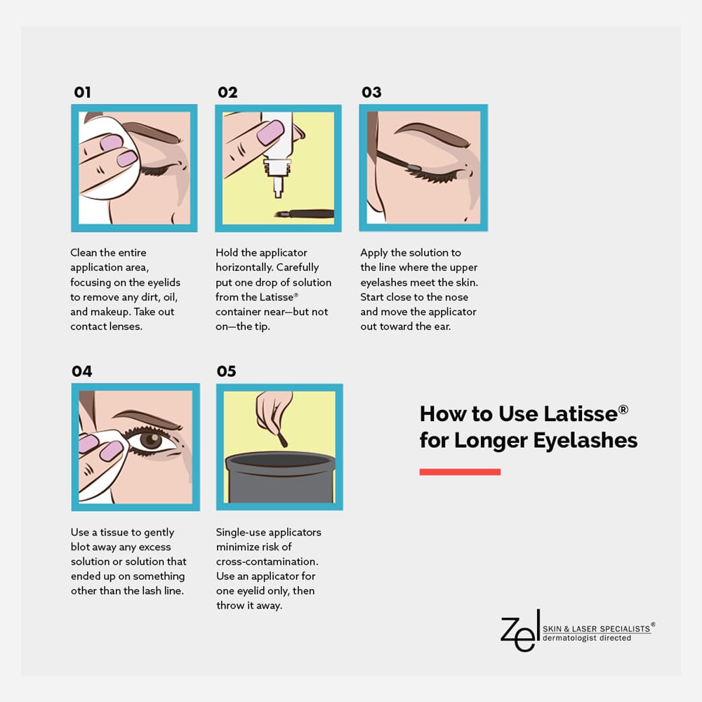 With just a few simple steps, you can use Latisse® from the Minneapolis area's Zel Skin & Laser Specialists to make your eyelashes more noticeable and fuller.