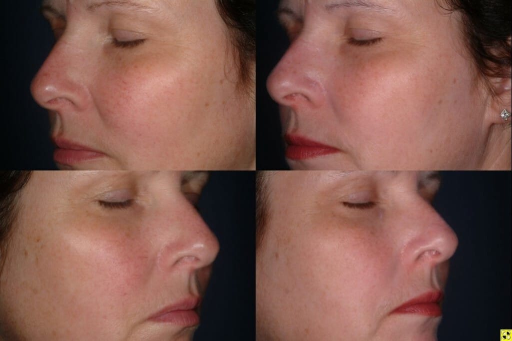 Facial Redness And Swelling 36