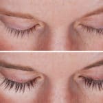 eyelash thickener Latisse before and after