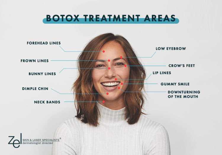 The Zel Skin team uses BOTOX in Edina, Plymouth, and Minneapolis for a wide range of treatments, all designed to give the face a more relaxed and youthful look.