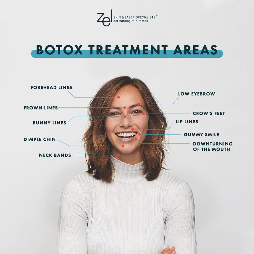 The Zel Skin team uses BOTOX in Edina, Plymouth, and Minneapolis for a wide range of treatments, all designed to give the face a more relaxed and youthful look.
